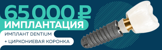 20260831_ сайт нижний баннер_АКЦИИ_65 000 имплант_Dentium_v01.jpg